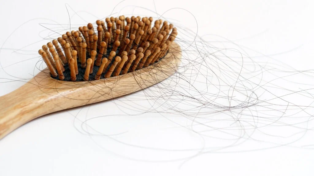 έντονη-τριχόπτωση