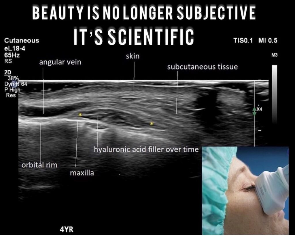 υπέρηχο δέρματος - Άουρα Υφαντή