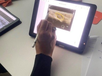 υπέρηχος δέρματος