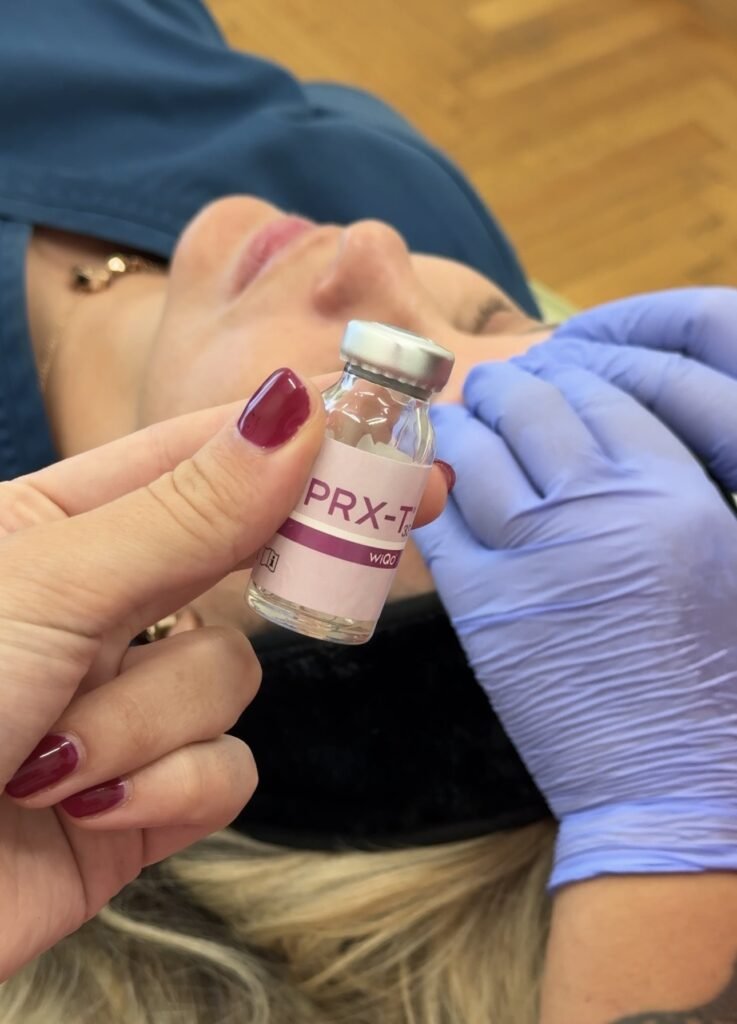 PRX Peeling
